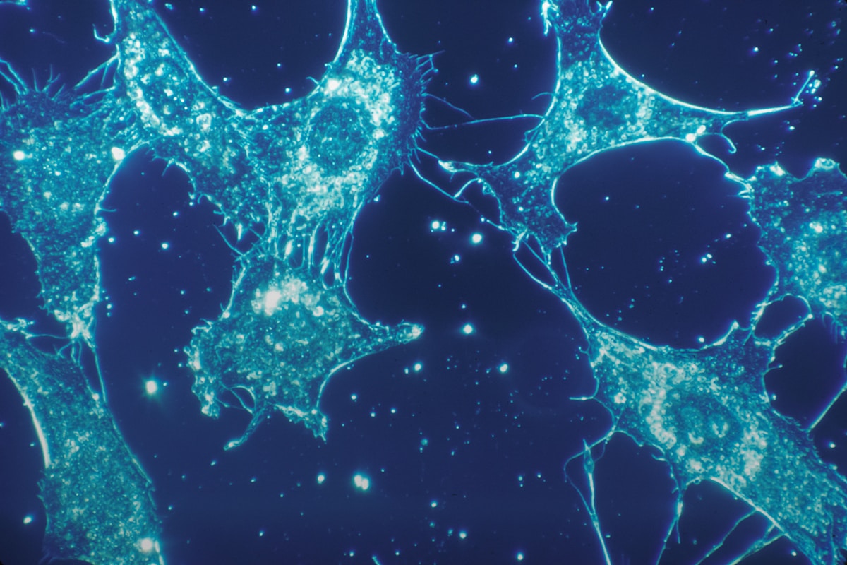 Fluoreszenzmikroskopische Aufnahme menschlicher Bindegewebszellen in Kultur